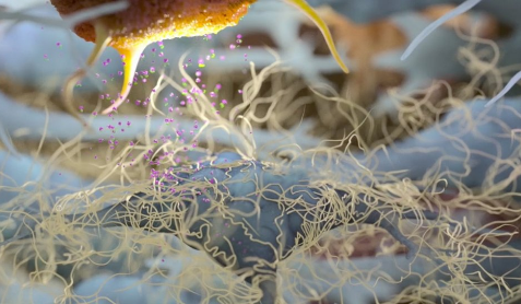 A depiction of tissue with an overabundance of collagen deposits