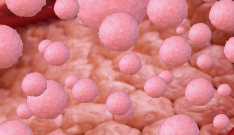 A depiction of less-inflamed tissue with an abundance of pink cells