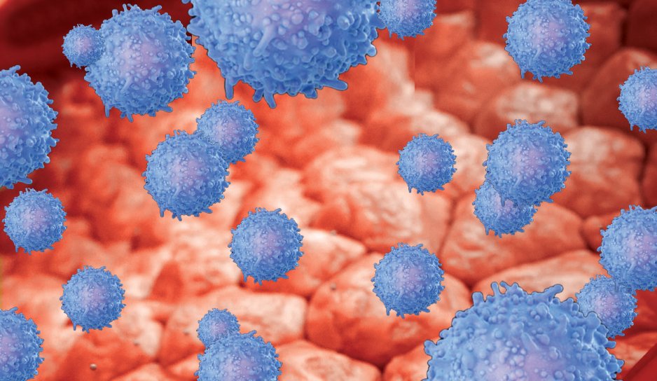 a depiction of inflamed tissue with an overabundance of blue cells and an arrow pointing up indicating an increase in pro- inflammatory cells